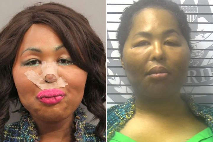 В Алабаме трансгендер ограбил банк, чтобы оплатить пластическую операцию