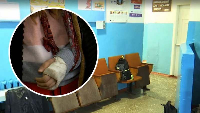 У школі під Одесою учениці на зламану руку поклали рибу і відправили додому (ФОТО)
