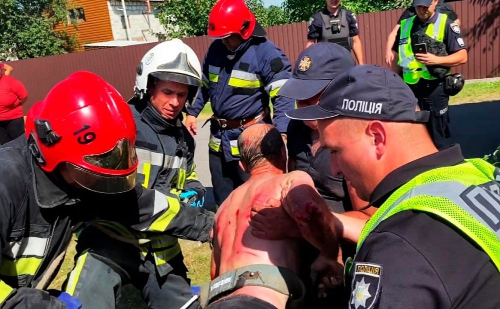 На Київщині чоловік упав у глибоку криницю (ВІДЕО)
