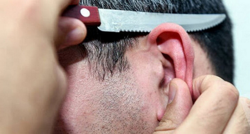 У Дніпрі чоловікові серед білого дня відрізали вухо (ФОТО)
