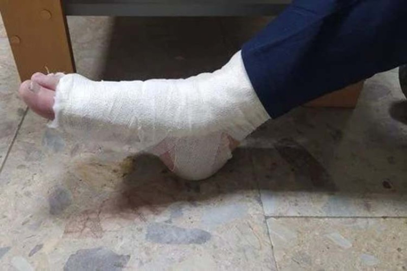На Тернопільщині чоловік, викрадаючи велосипед, зламав ногу