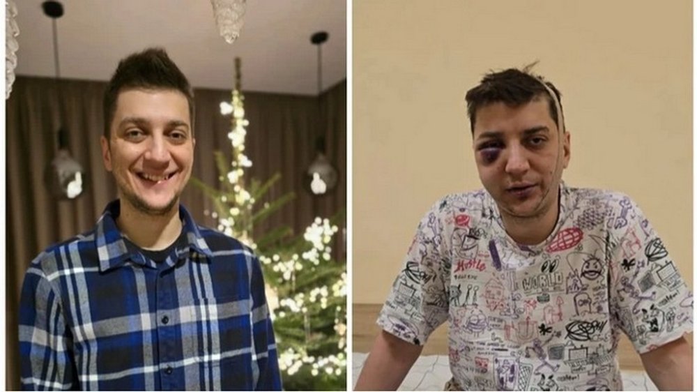 Поліція розслідує причетність свого співробітника до побиття чоловіка в Гостомелі