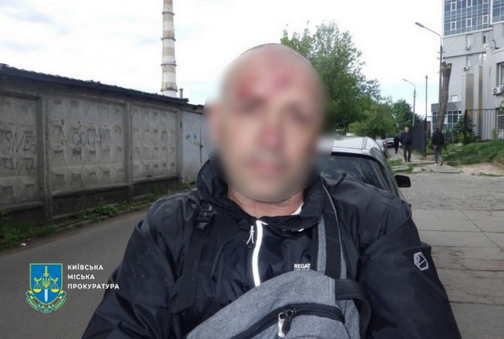 Зловмисник домовився з киянином про вигідний обмін $10 тис., а на зустрічі пограбував його