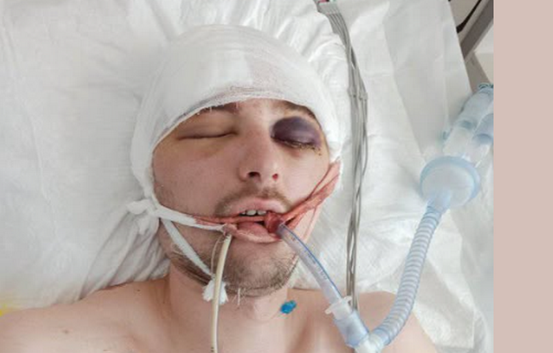 На Львівщині мобілізований вистрибнув із вантажівки дорогою на полігон: чоловік перебуває у комі