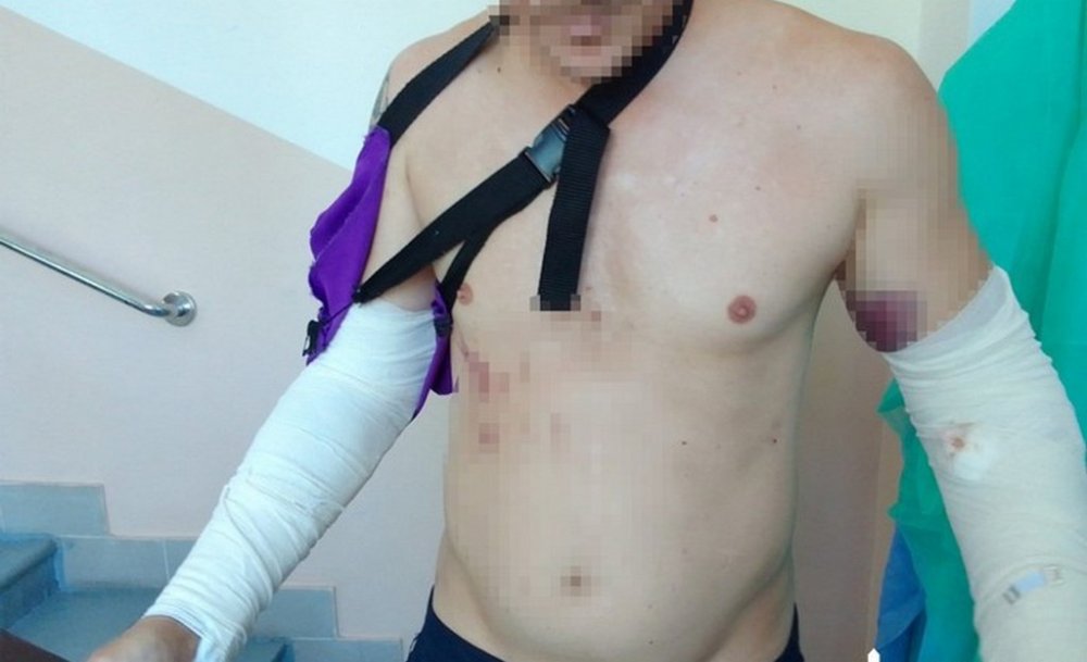 Повідомлено про підозру інструктору, який побив військовослужбовця на навчальному полігоні
