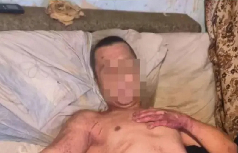 На Закарпатті чоловік вбив жінку, а потім відрізав собі геніталії