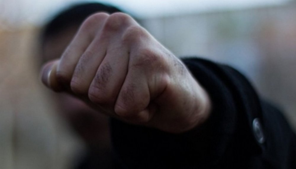 У Дніпрі повідомлено про підозру, який побив людину за просте зауваження