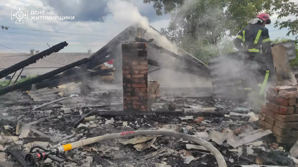 На Житомирщині помер у лікарні маленький хлопчик, який постраждав під час пожежі (ФОТО)