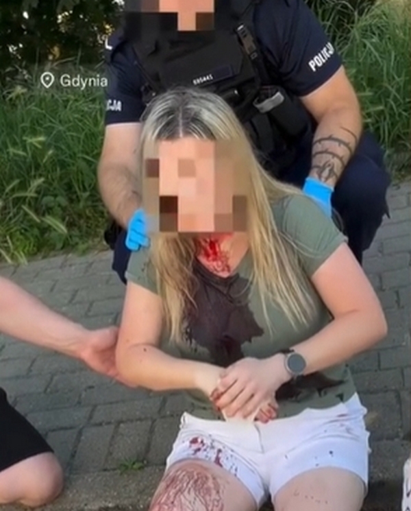 У Польщі затримали покидька, який побив українку палицею по голові (ФОТО)