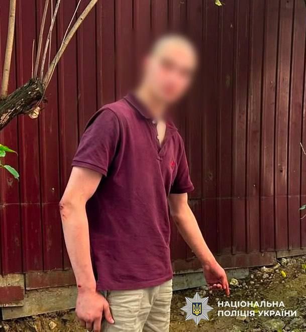 «Стрілку» з Голосієва загрожує до п’яти років обмеження волі: подробиці від поліції (ФОТО)